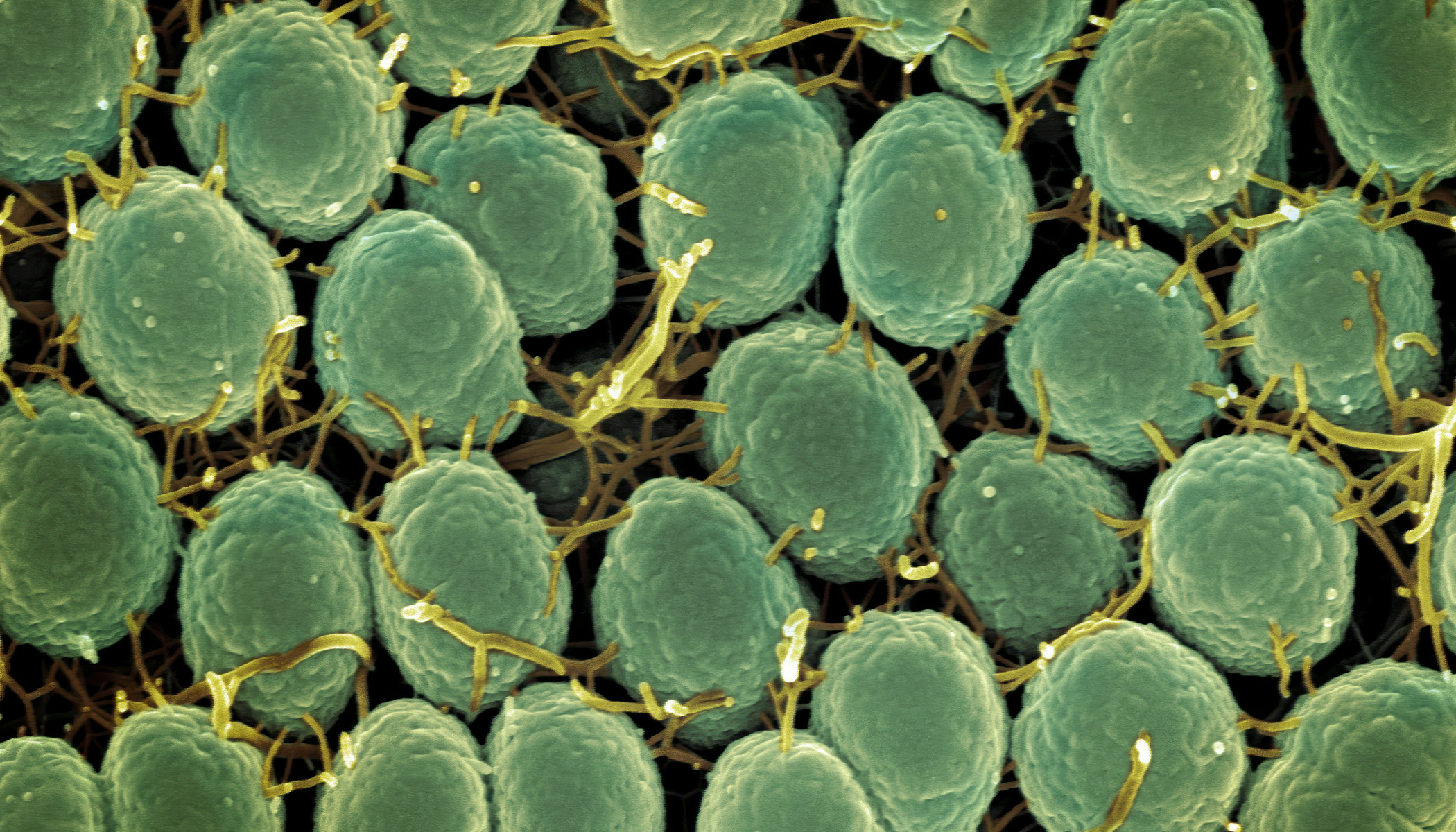 BioTryp Therapeutics Raises Pre Seed Funding - anti-biofilm